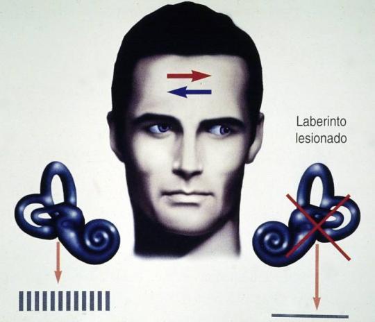 Rehabilitación » Sordera Y Vértigo